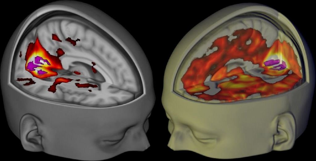 Neuroplasticidade, rede de modo padrão, psicodélicos